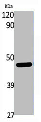 CNP antibody