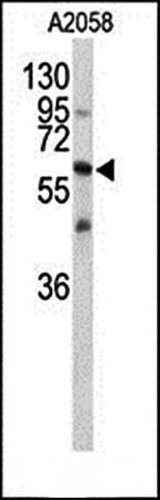 CNTN1 antibody