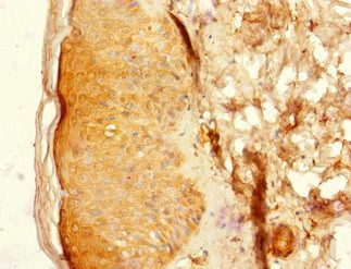 CNTN4 antibody