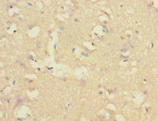 CNTNAP1 Antibody