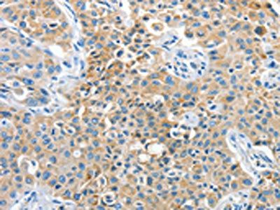 CNTNAP3 Antibody