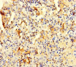 COTL1 Antibody