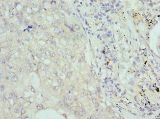 COCH Antibody