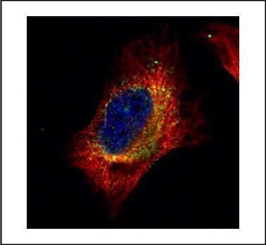 Cofilin 2 Rabbit Polyclonal Antibody