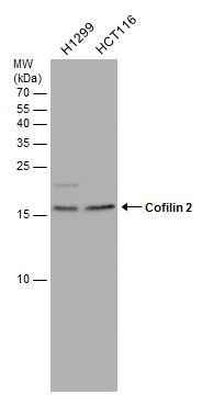 Cofilin 2 Rabbit Polyclonal Antibody