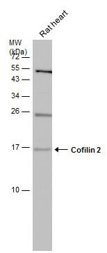 Cofilin 2 Rabbit Polyclonal Antibody