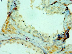 COL10A1 Antibody
