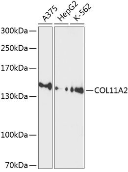 COL11A2 antibody