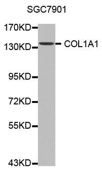 Collagen I antibody