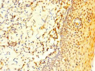 COL20A1 Antibody