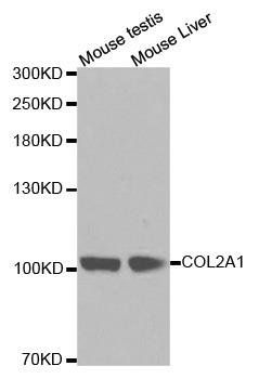 COL2A1 antibody