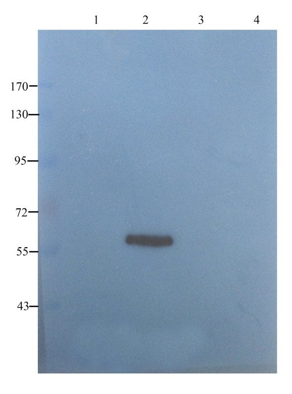 Collagen IV antibody