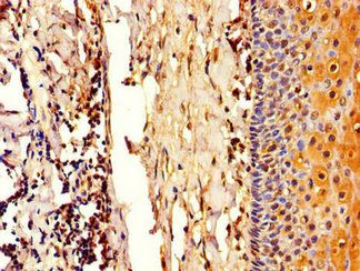 COL4A3BP antibody