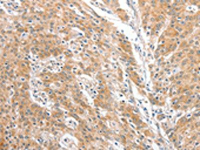 COL4A3BP Antibody