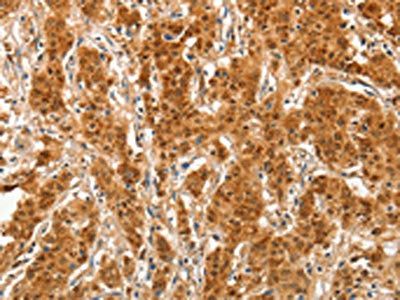 COL4A3BP antibody