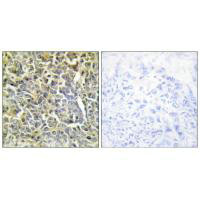 COL6A2 antibody