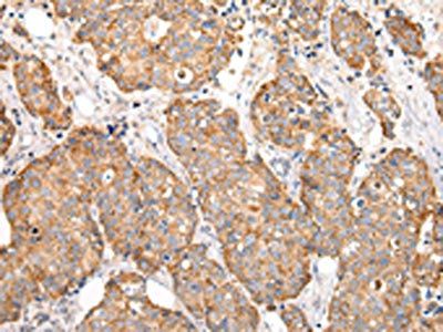 COL8A2 Antibody