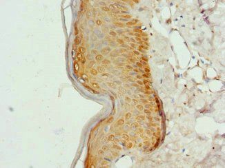 COL9A3 antibody