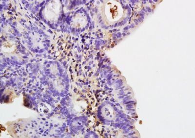 COLEC10 Rabbit Polyclonal Antibody