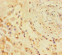 COL11A1 Antibody