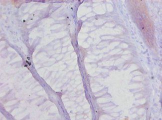 COL17A1 Antibody