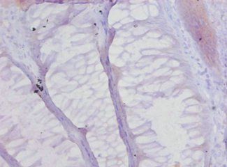 Collagen alpha-1(XVII) chain antibody