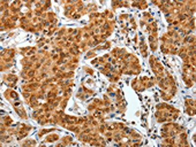 COL1A2 Antibody