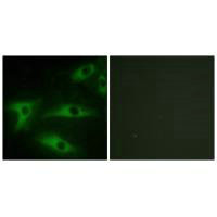 COL1A2 Antibody
