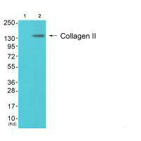 Collagen II antibody