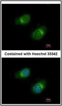 Collagen III antibody