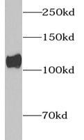 Collagen Type I antibody