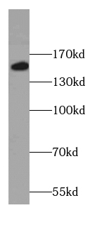 Collagen Type XVI antibody