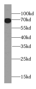 Collagen Type XXIII antibody