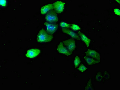 Collagen VI antibody