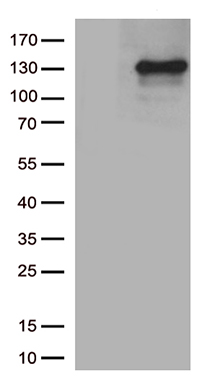 Collagen VI (COL6A1) antibody