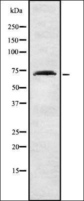 Collagen VIII alpha1 antibody