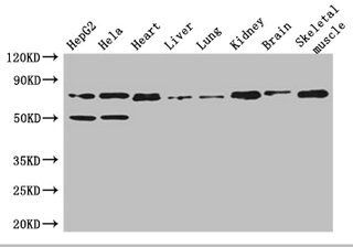 Collagen VIII antibody