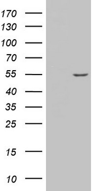 Collagen XV (COL15A1) antibody