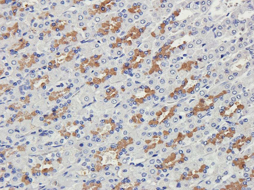 Collagen 4 alpha 1 Rabbit Polyclonal Antibody