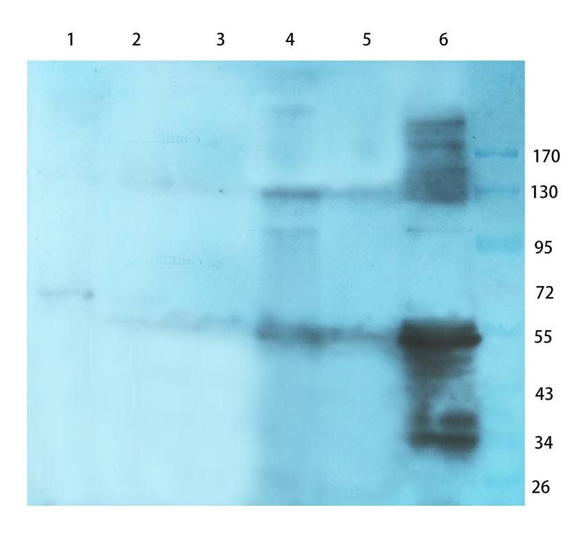 Collagen 4 alpha 1 antibody