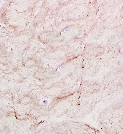 COL2A1 Rabbit Polyclonal Antibody