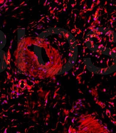 COL2A1 Rabbit Polyclonal Antibody