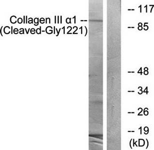 Collagen III (Cleaved-Gly1221) antibody