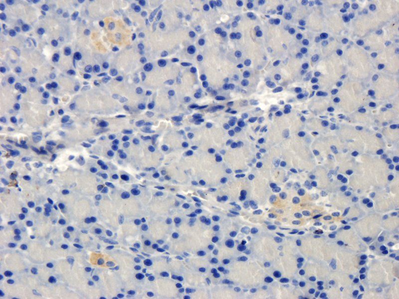 Collagen III antibody