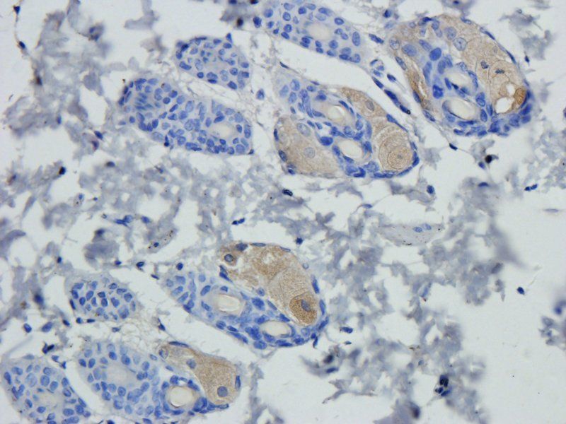 Collagen III Rabbit Polyclonal Antibody