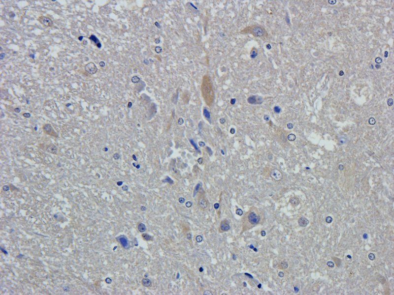 Collagen III antibody