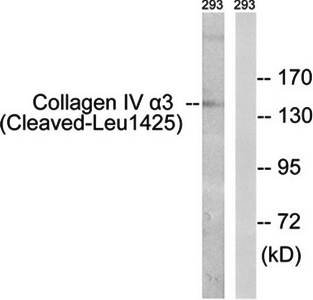 Collagen IV (Cleaved-Leu1425) antibody