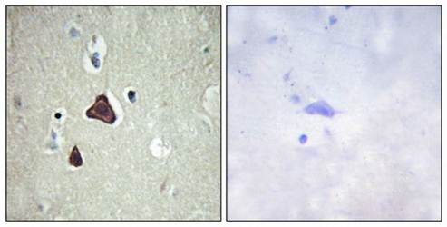 Collagen IX alpha3 antibody