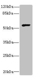 Collagenase 3 antibody