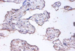 COMMD4 Antibody